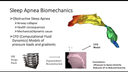 sleep apnea