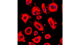 Free radical damage in apoptosis. Credit: Dr Jeremy Skepper.