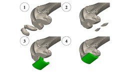 Human total knee replacement scaled for mice, senior project of Arvinth Sethuraman